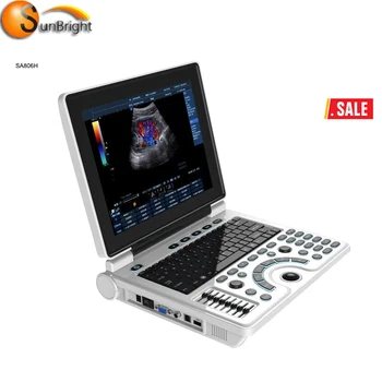 Prenosný Ultrazvuk Skener Diagnostický Systém lekárske ultrazvuk skener Notebook Štýl Lekárske Ultrazvuk